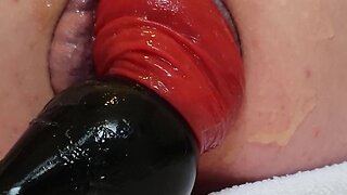 Unparalleled Anal Prolapse HD Videos: Up Close and Personal