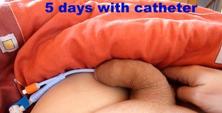 How I handle everyday life with a catheter that I had in me for 6 days.