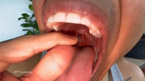 Abhi Swallows Tiny Loser