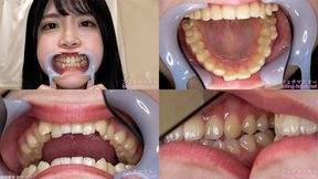 Akari - Watching Inside mouth of Japanese cute girl bite-265-1 - MOV