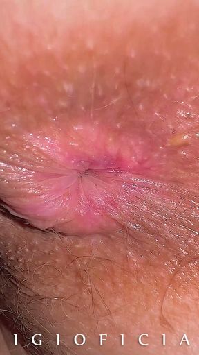 What if we take HIGH END CLOSE UP CAMERA and shot 18 years old girl butthole close up?   Clip 1