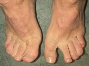 Slideshow of His Hard Working, Rough Feet (2021-09-21) In Desperate Need Of A Professional Pedicure