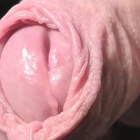 Foreskin closeup 335