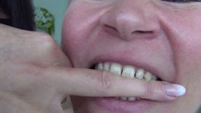 Victoria bites my hand and my fingers hard FF