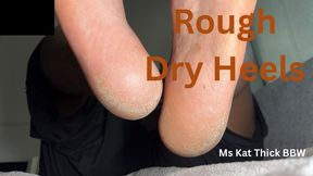 Rough Dry Heels Worship