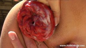 Kinky summer babe breached in anal hole, fisting, prolapse outdoor