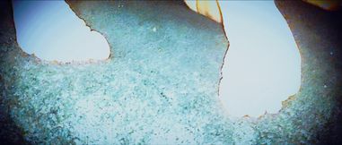 The World’s Saddest Midget Foot Fetish