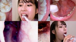 Mino ri Mashiro - Observing Mino ri's teeth, mouth, and back of the throat with a dental camera - MOV 1080p
