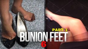 Fetish207 - Foot Fantasies, Bunion Feet 6, Part 1