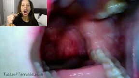 Endscope Mouth Tour - Sunshine - 720 MP4 HD