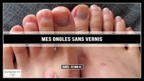 Mes ongles à nu