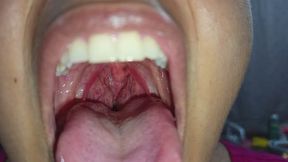 Lengua juguetona, amígdalas grandes. Revisión de lengua y boca.