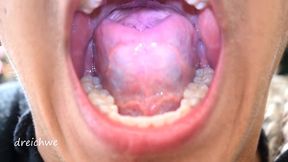 uvula fetish