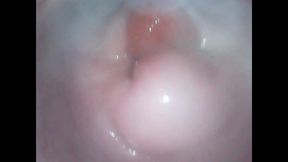 Endoscope in my vagina again