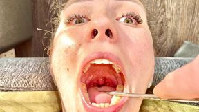 Doctor's Deep Oral Examination POV