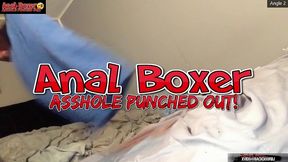 asshole punched out - ass monkey xl inflatable buttplug angle 2 part 1