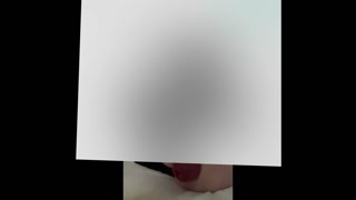 A huge anal prolapse has fallen out and is hanging from a young guy who is lying on the bed on his b