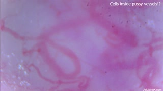 Cells moving inside pussy vessels!