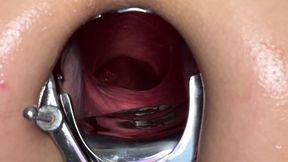 24.01.2024 Quickie Hotkinkyjo - Anal, Gape, Analgape, Boobs, Ass, Speculum, Anal Speculum, Extreme Insertions, Insertions