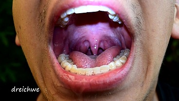 Early morning uvula