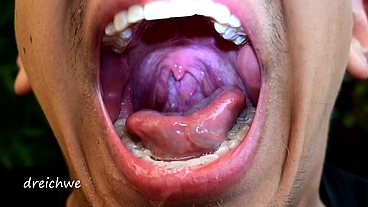 Early morning uvula