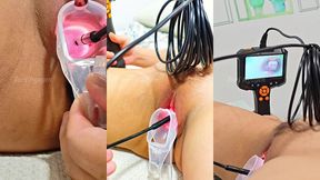 [viet nam] nội soi kham pha ben trong bim xinh ẩm ướt...