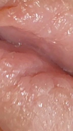 Enlargement of the Deep Urethral Hole!!
