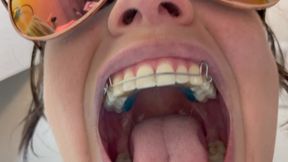 Giantess With Braces Vore POV