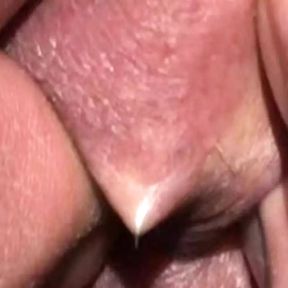 Close-Up Sack Piercing