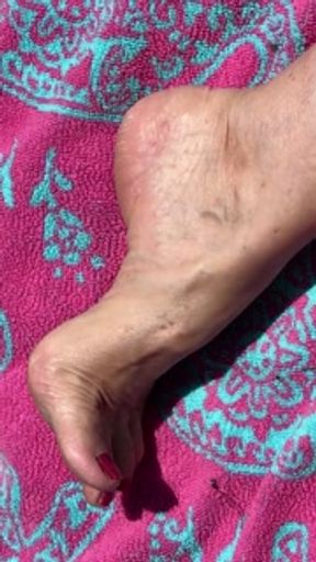 Fan Request Granny Naked In Sun Shows Dirty Rough Soles &amp; Toes GILF 2