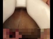 Uncircumcised penis pee
