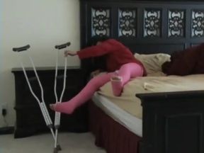 injury broken legs