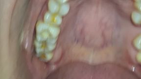 “Close-Up Dental: The Charm of My Smile”