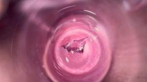 Inside Mia's Vagina, Internal Camera in Teen Pussy