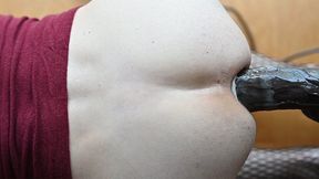 Anal sound