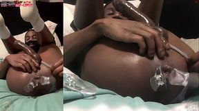 *PREMIUM* TWO ANGLES | HUGE Lips On My Asshole! | 1 and 2 OF 2 - Starring DJ ButtPussy