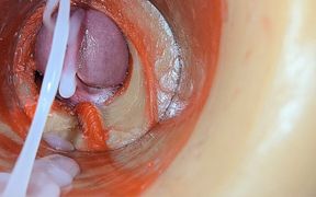 Female Insemination - Internal Camera Captures Deep Male Huge Ejaculation