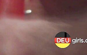 Speculum des deutschen Amateurs klaffenden Peelochabenteuer