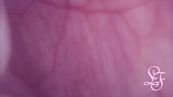 Fucked in my Pussy   Camera in my Bladder = Crazy Bulge!