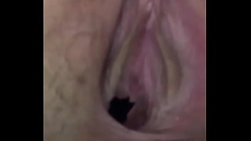 Vagina besucona