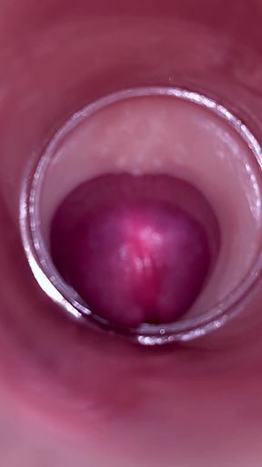 Female Insemination - Internal Camera Captures Deep Male Ejaculation