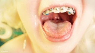 eating in braces - vore and food fetish - close up video