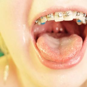 eating in braces - vore and food fetish - close up video