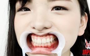 Teeth Observation Natural Teeth but Potential Cavities Found!! Beauty Winces When Her Teeth Are Tapped - Suzu Shiratori