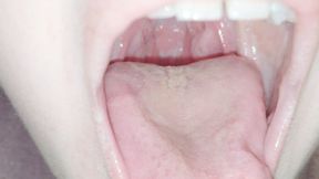 My bright red uvula