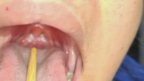 "Close-Up of My Uvula"