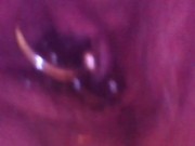 Close up otoscope endoscope pee peeing urine piss pissing
