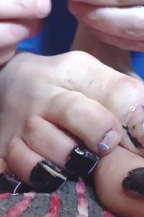 Tons of toenails compilation