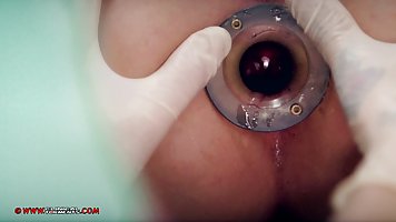 Valentina Bianco likes the way a kinky nurse, Minerva is playing with her wet pussy