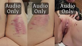 more pretty bruises and the story of how i got them